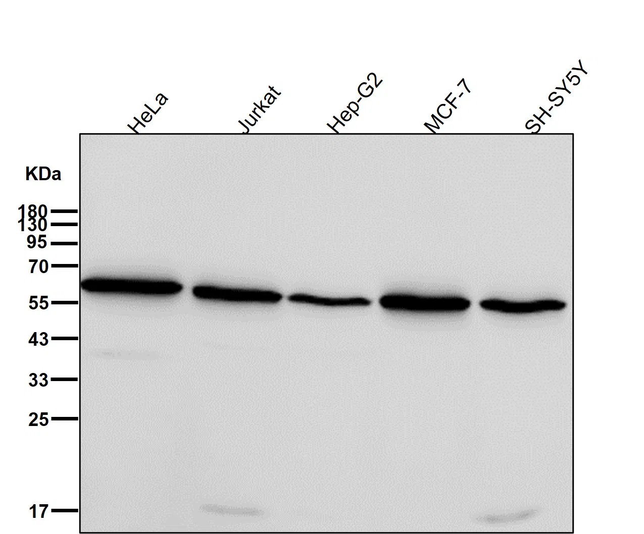 Retinoic Acid Receptor alpha Rabbit Monoclonal Antibody - Size: 50µl