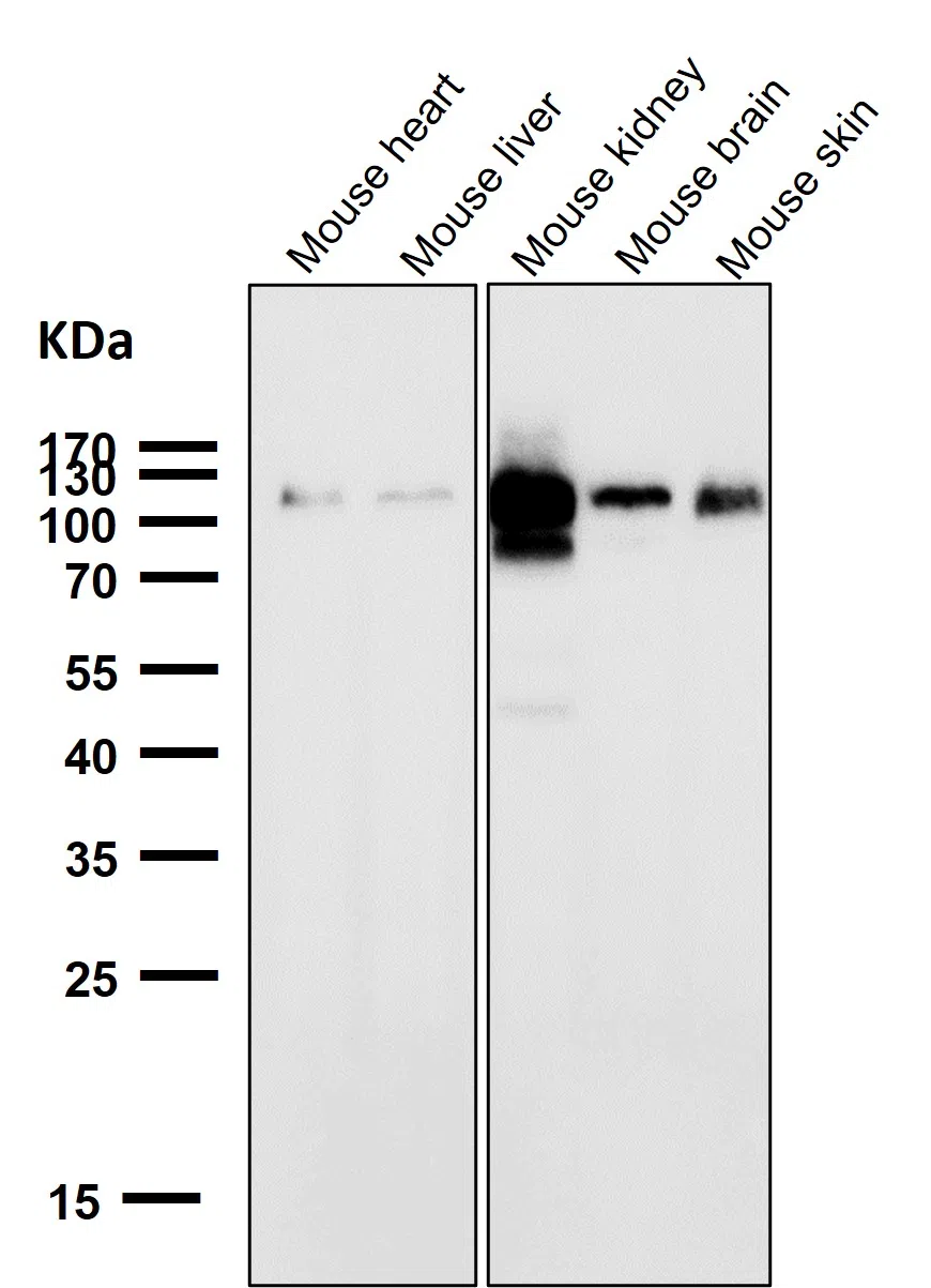 ACE2 Rabbit Monoclonal Antibody - Size: 50µl