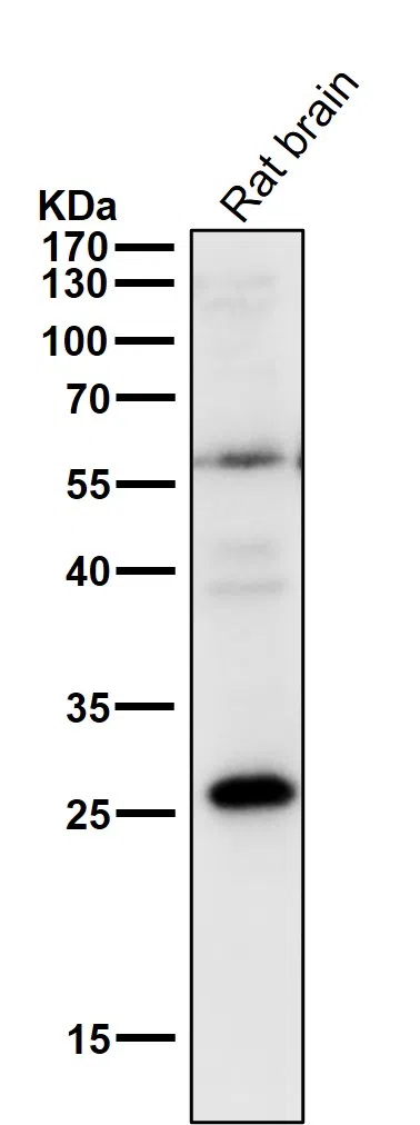PPP1R1A Rabbit Monoclonal Antibody - Size: 50µl