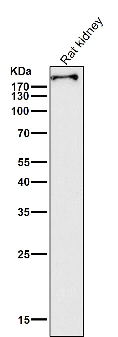 BRG1 Rabbit Monoclonal Antibody - Size: 50µl