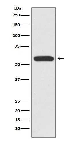 IRF6 Rabbit Monoclonal Antibody