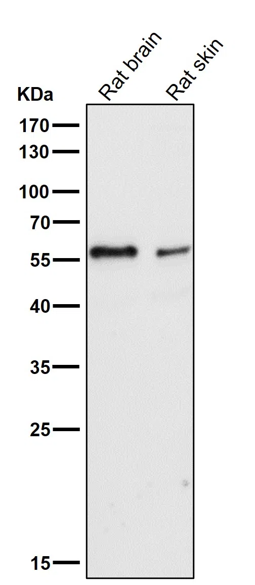 IRF5 Rabbit Monoclonal Antibody