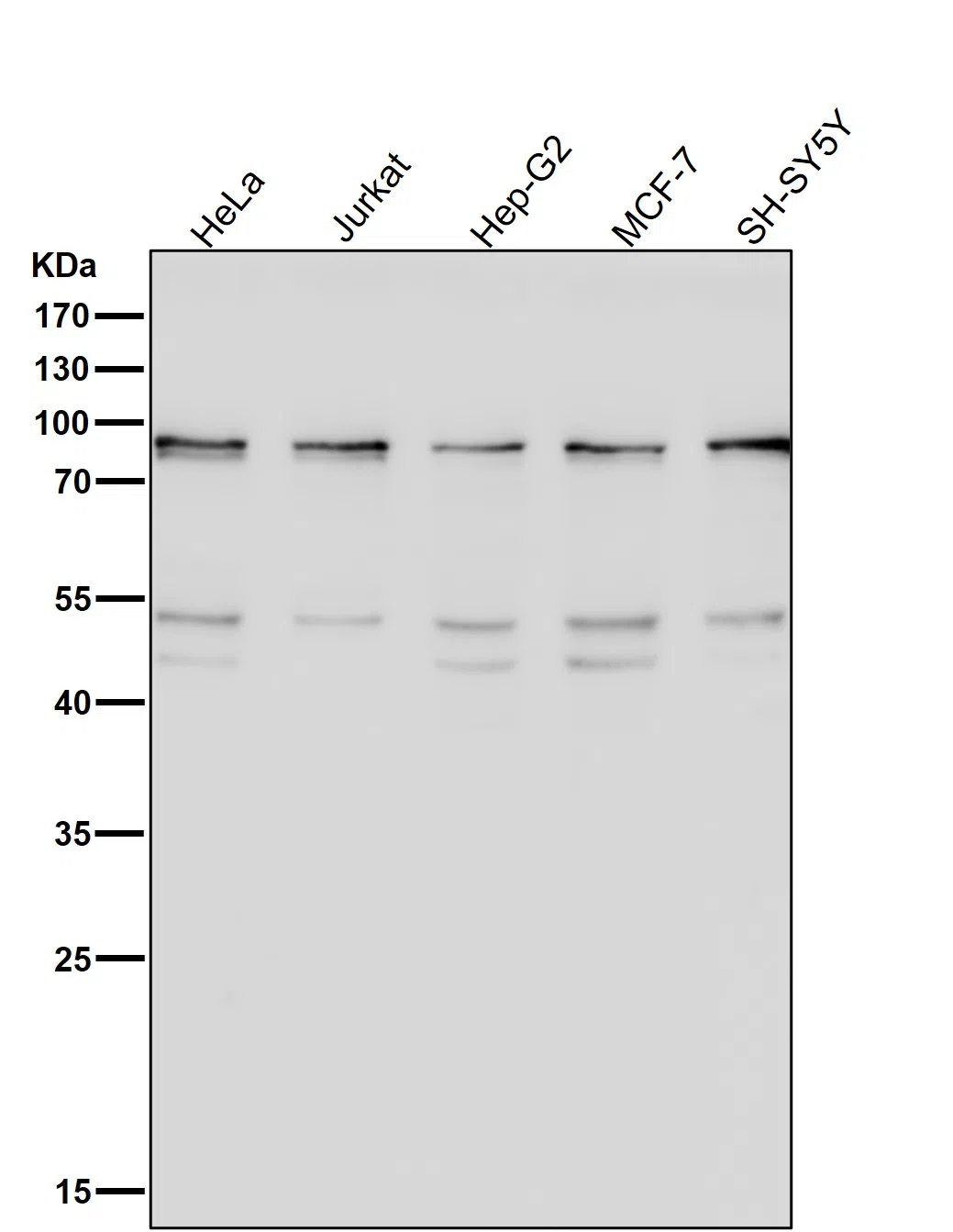 STAT1 alpha Rabbit Monoclonal Antibody - Size: 50µl