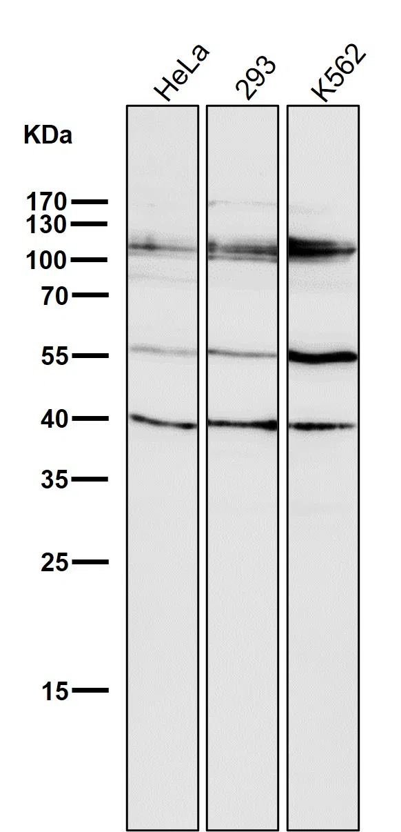 HDAC7 Rabbit Monoclonal Antibody - Size: 100µl