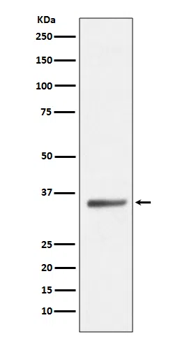 SIRT5 Rabbit Monoclonal Antibody - Size: 100µl