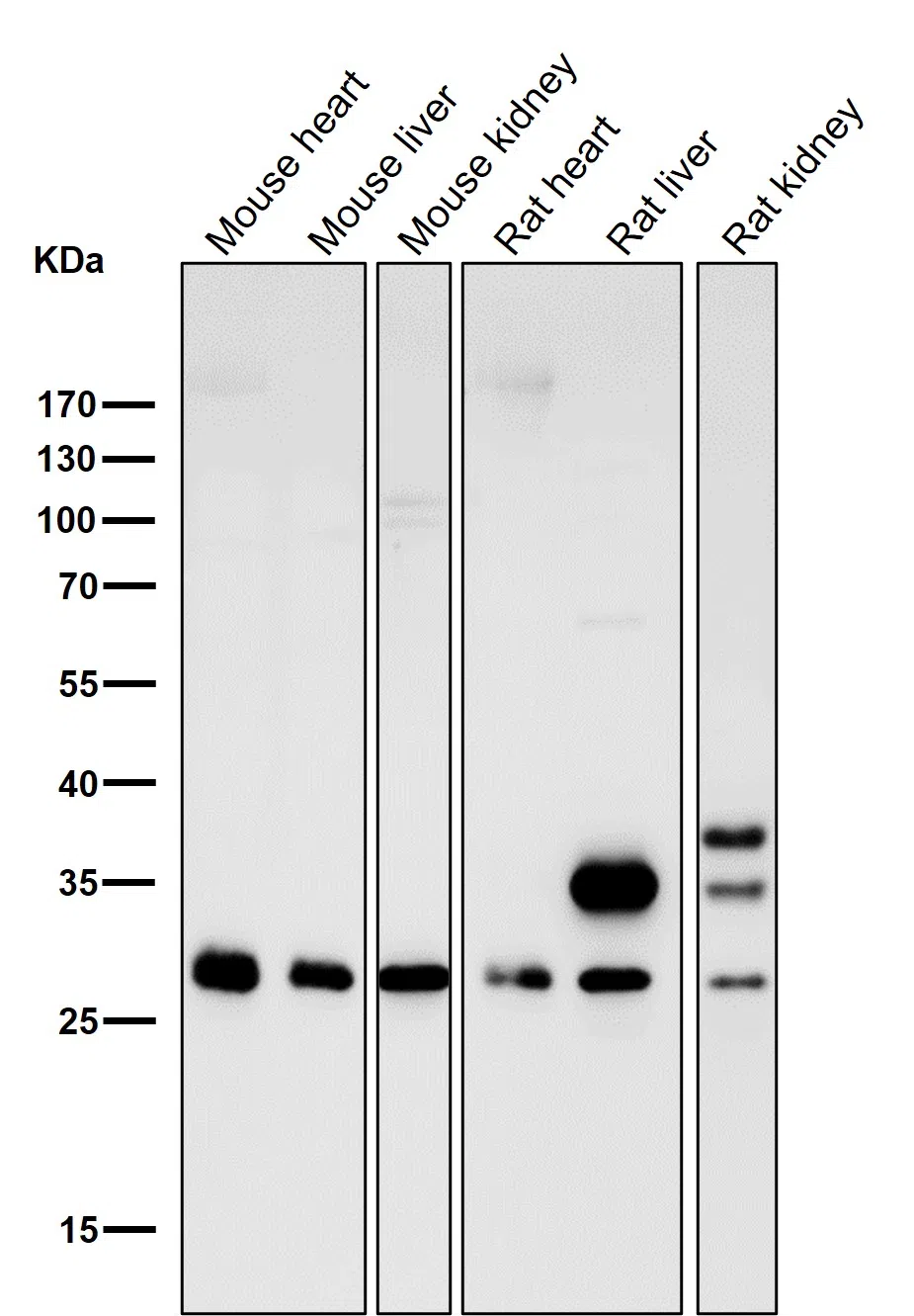 CDCA3 Rabbit Monoclonal Antibody - Size: 50µl