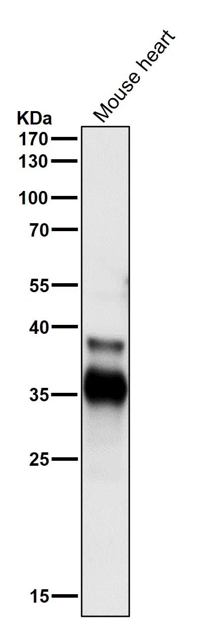 Cdc34 Rabbit Monoclonal Antibody - Size: 50µl