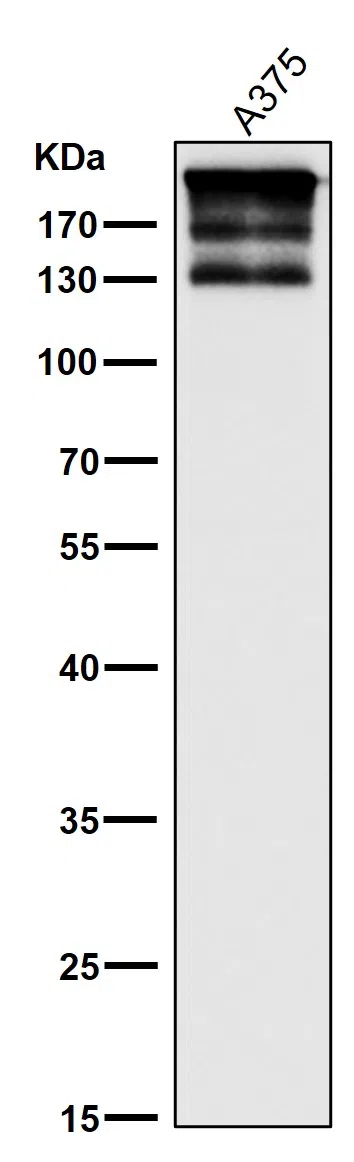 ARID1A Rabbit Monoclonal Antibody - Size: 50µl
