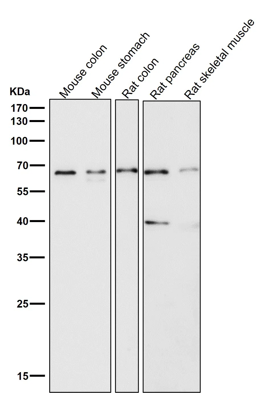 Occludin Rabbit Monoclonal Antibody - Size: 50µl