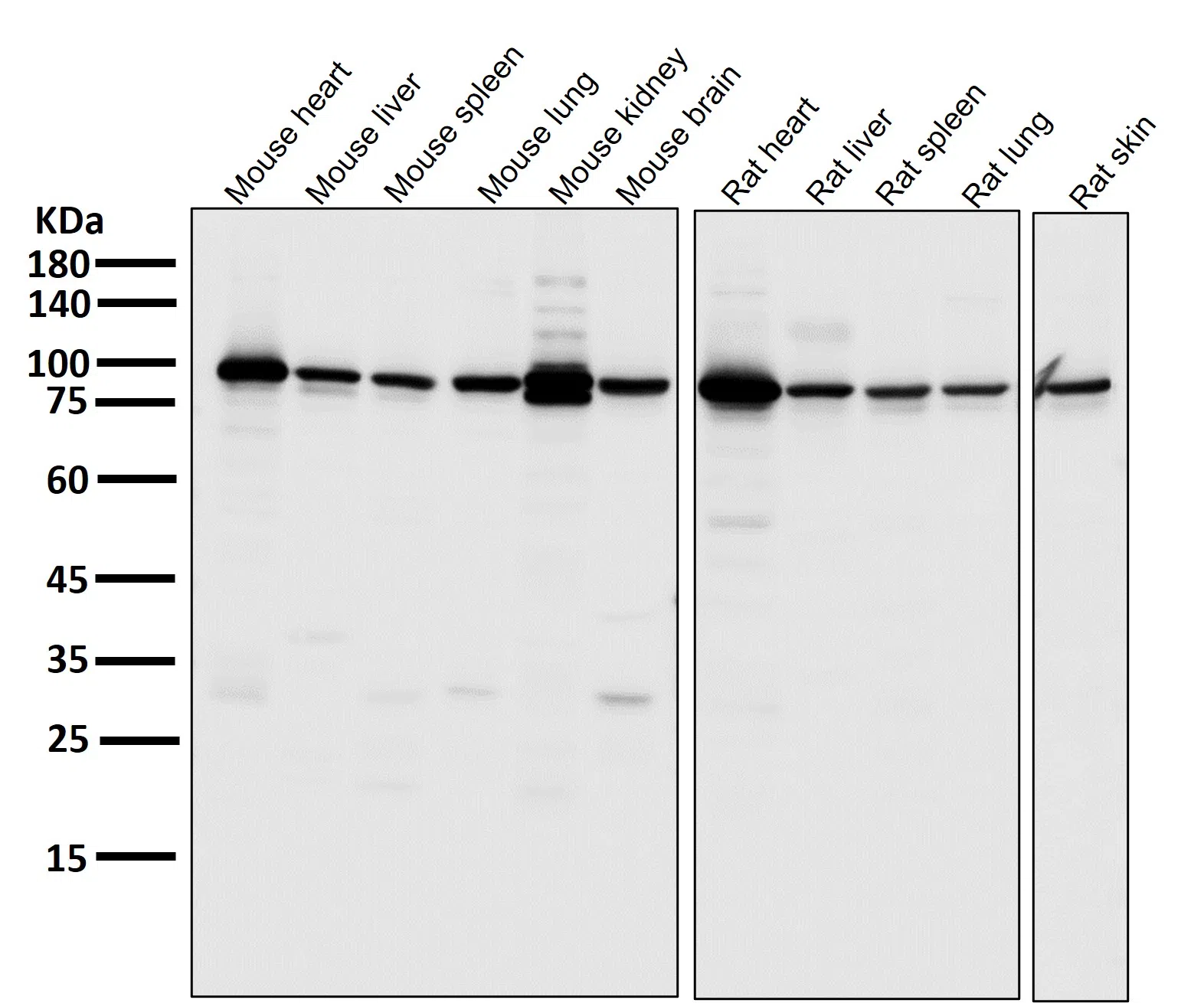 PGC1alpha/beta Rabbit Monoclonal Antibody