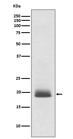 Ras Rabbit Monoclonal Antibody - Size: 100µl