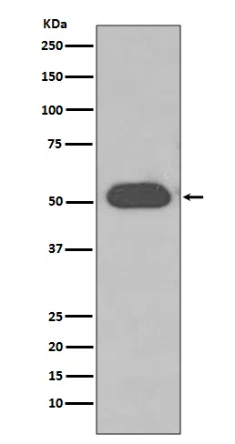 GC/VDBP Rabbit Monoclonal Antibody - Size: 100µl