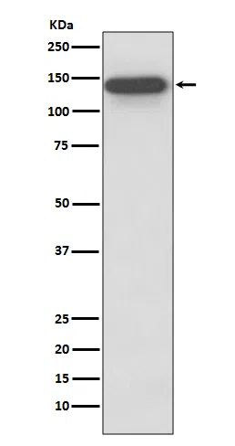 SMC3 Rabbit Monoclonal Antibody - Size: 100µl