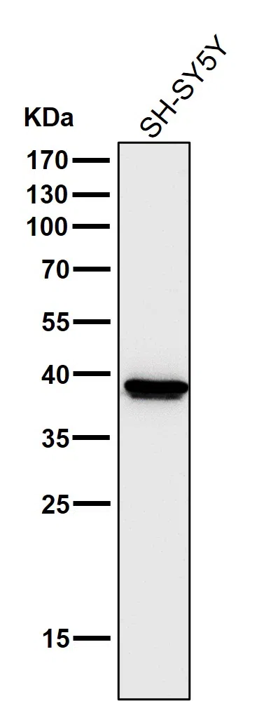 Cathepsin L/V/K/H Rabbit Monoclonal Antibody - Size: 100µl