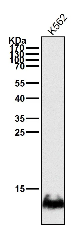 HBG1/2 Rabbit Monoclonal Antibody - Size: 100µl