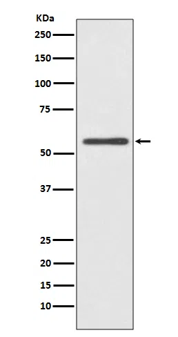 CYP2E1 Rabbit Monoclonal Antibody - Size: 100µl