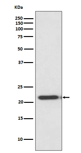 WesternBlot(WB) - TIMP2 Rabbit Monoclonal Antibody AMRe83919