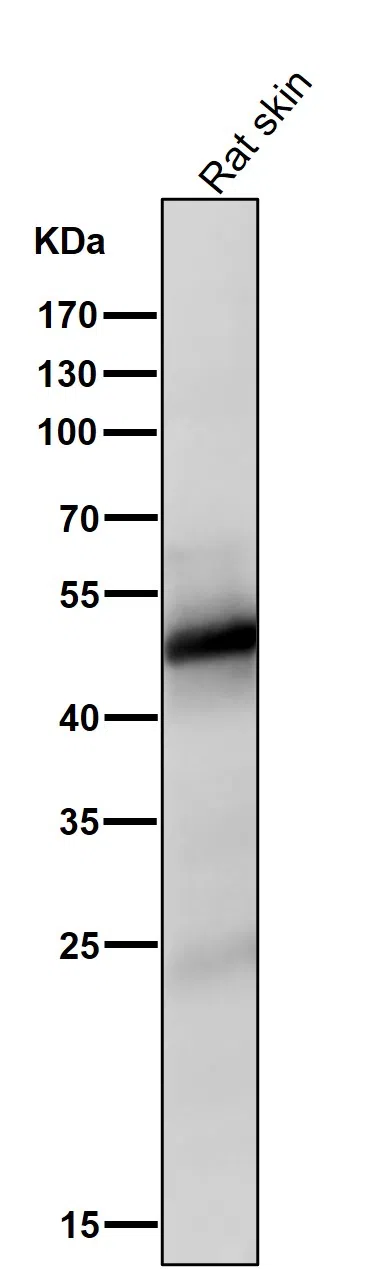 Vitamin DR eceptor Rabbit Monoclonal Antibody