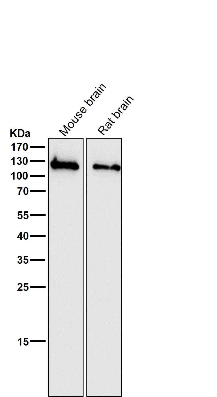 NMDAR1 Rabbit Monoclonal Antibody - Size: 100µl