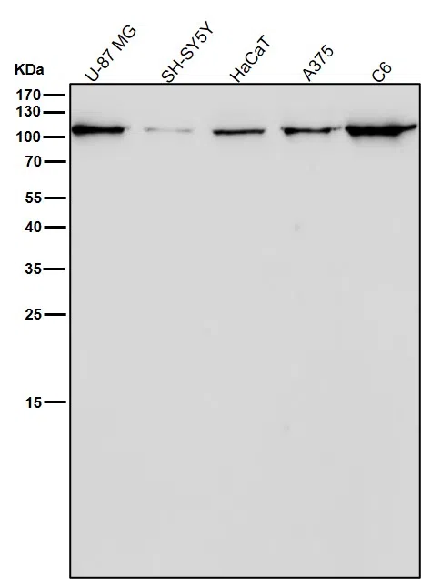 CD26 Rabbit Monoclonal Antibody - Size: 100µl