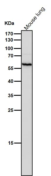 CalcineurinA Rabbit Monoclonal Antibody - Size: 100µl