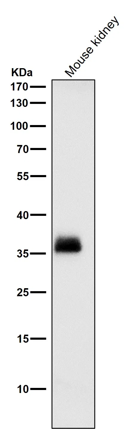 SFRP1 Rabbit Monoclonal Antibody - Size: 50µl