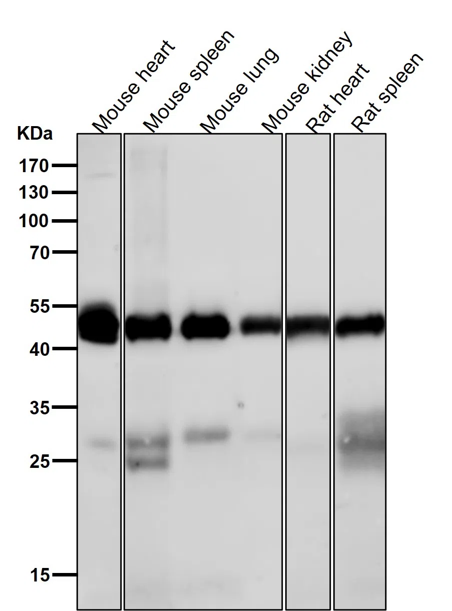 CaMKII delta Rabbit Monoclonal Antibody - Size: 100µl