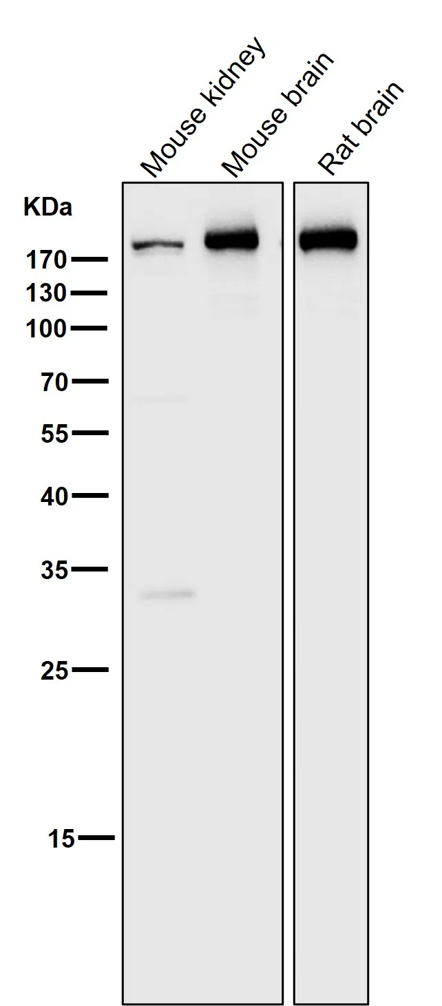 Clathrin heavy chain Rabbit Monoclonal Antibody - Size: 50µl