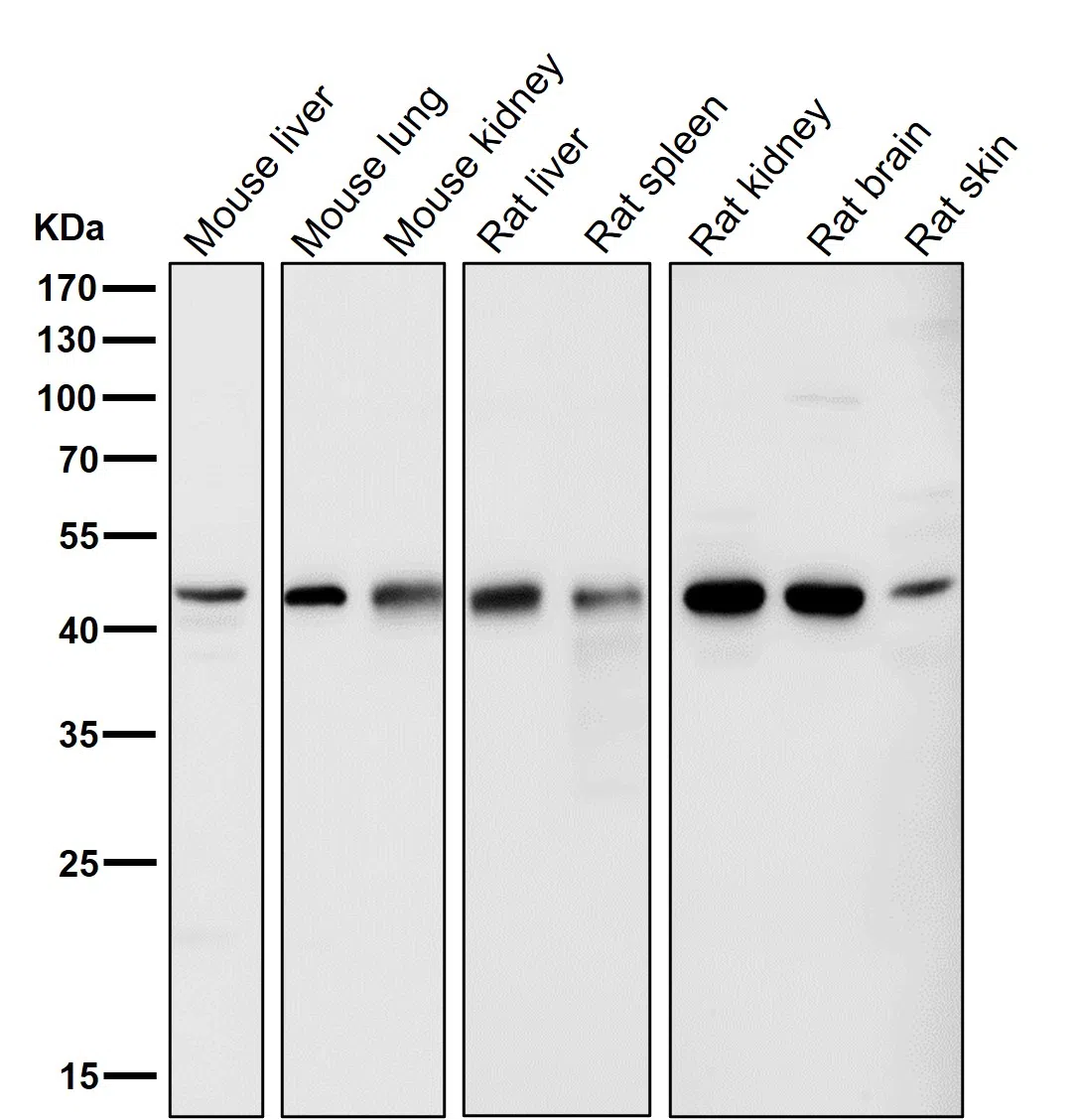 LXR alpha Rabbit Monoclonal Antibody - Size: 50µl