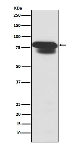 PIAS1+PIAS2 Rabbit Monoclonal Antibody - Size: 100µl