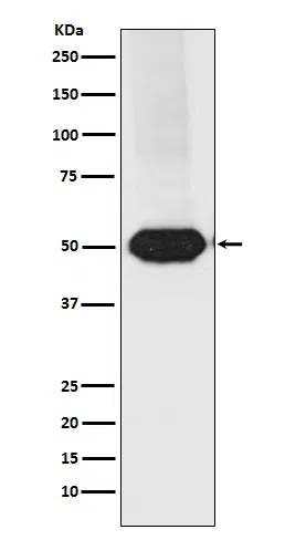 MEF2A/MEF2C Rabbit Monoclonal Antibody - Size: 100µl