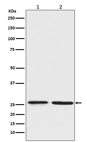 BNIP1 Rabbit Monoclonal Antibody - Size: 100µl