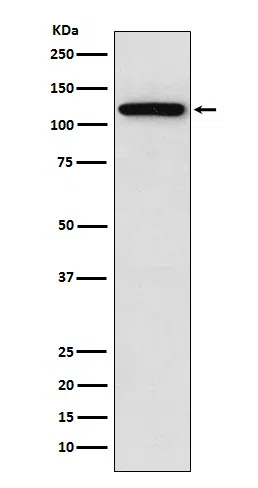 Sortilin Rabbit Monoclonal Antibody - Size: 100µl