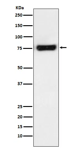 MTA2 Rabbit Monoclonal Antibody - Size: 50µl