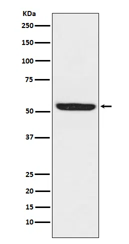 SPHK1 Rabbit Monoclonal Antibody - Size: 50µl