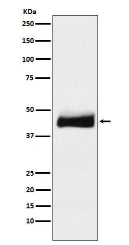ORM1 Rabbit Monoclonal Antibody - Size: 100µl
