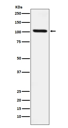 DDX58 Rabbit Monoclonal Antibody