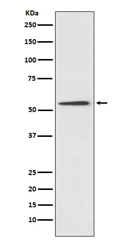 ProteinC Rabbit Monoclonal Antibody - Size: 100µl