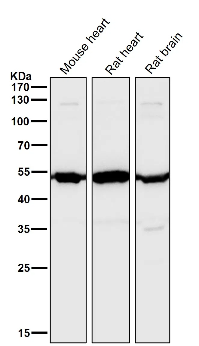 Angiopoietin 2 Rabbit Monoclonal Antibody - Size: 50µl