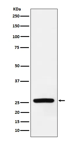Superoxide Dismutase 3 Rabbit Monoclonal Antibody - Size: 100µl
