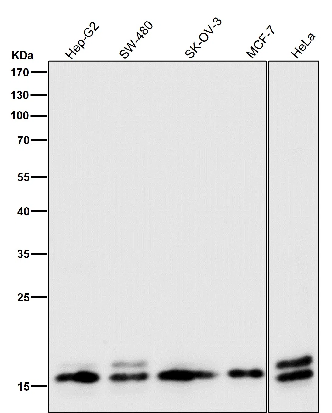 GABARAP Rabbit Monoclonal Antibody - Size: 100µl