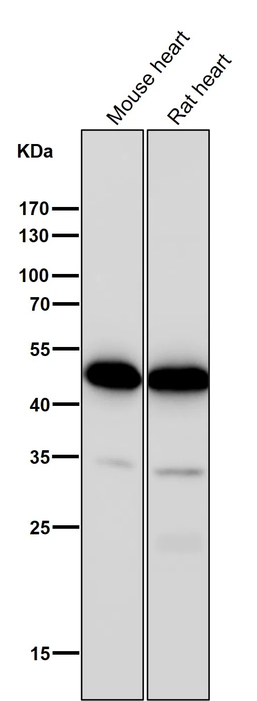 CCR8 Rabbit Monoclonal Antibody