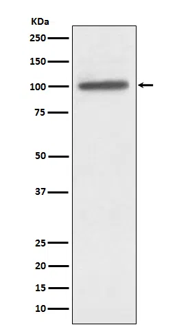 alpha Actinin 4 Rabbit Monoclonal Antibody - Size: 100µl