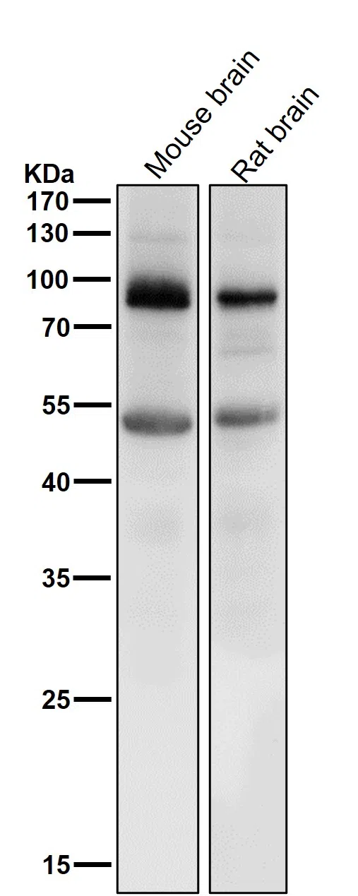Prolactin Receptor Rabbit Monoclonal Antibody - Size: 50µl