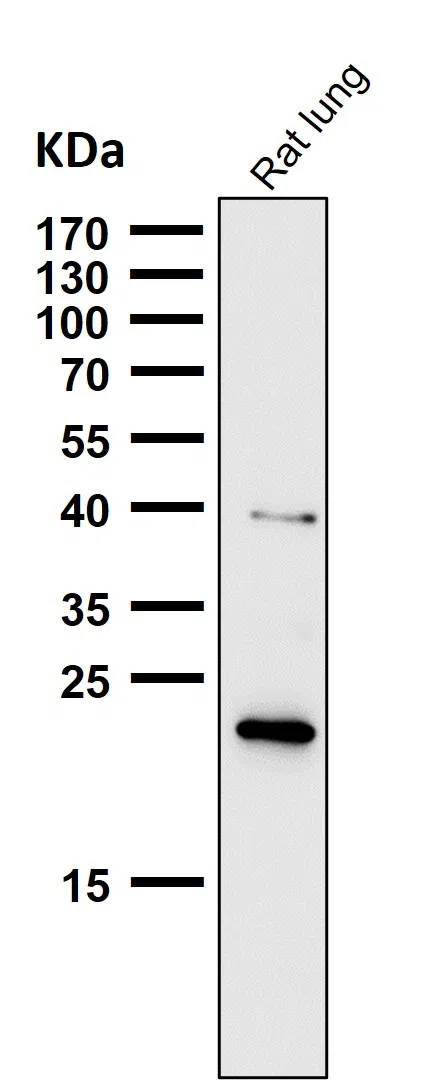 Ferritin Heavy Chain Rabbit Monoclonal Antibody - Size: 100µl