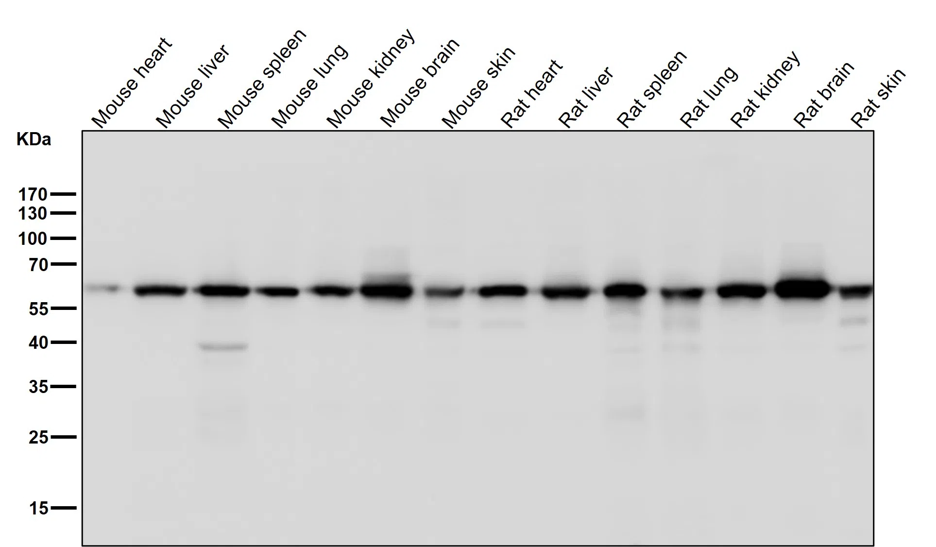KAT9/Elp3 Rabbit Monoclonal Antibody - Size: 100µl