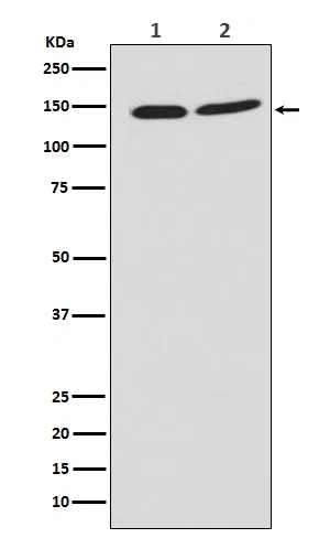 PHF8 Rabbit Monoclonal Antibody