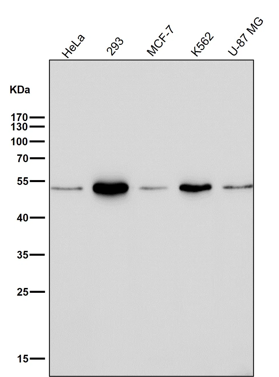 Ephrin B2 Rabbit Monoclonal Antibody
