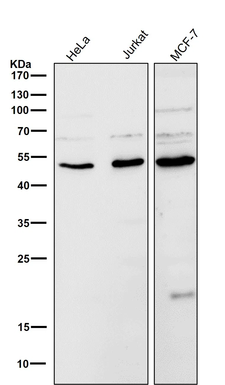 LOXL2 Rabbit Monoclonal Antibody - Size: 50µl