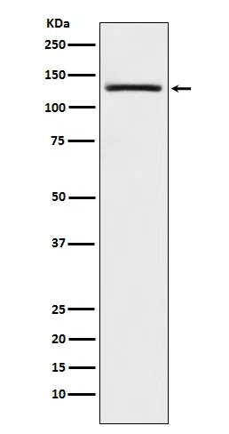 USP28 Rabbit Monoclonal Antibody - Size: 100µl